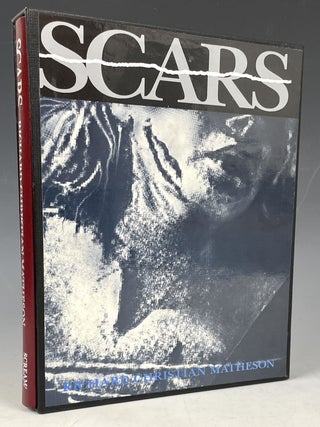 Item #1077 Scars and Other Distinguishing Marks. Richard Christian Matheson