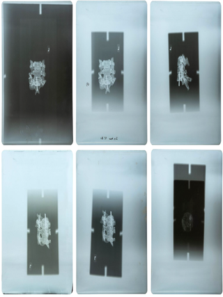 Item #3312 Group of 21 Original X-Rays Depicting Fragments of Abraham Lincoln's Skull and...