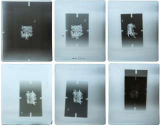 Item #3312 Group of 21 Original X-Rays Depicting Fragments of Abraham Lincoln's Skull and...