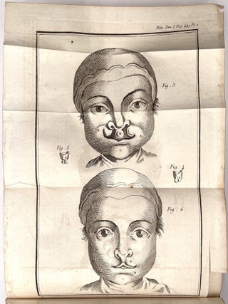 Memoires de L’ Academy Royale de Chirurgie (Memoirs of the Royal Academy of Surgery), 5 Vols.