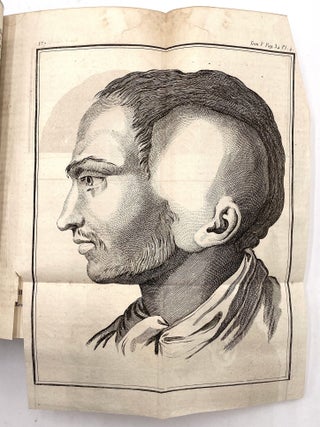 Memoires de L&rsquo; Academy Royale de Chirurgie (Memoirs of the Royal Academy of Surgery), 5 Vols.