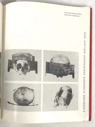 Dioses y Enfermedades (Gods and Disease: Medicine in Ancient Peru)