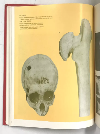 Dioses y Enfermedades (Gods and Disease: Medicine in Ancient Peru)